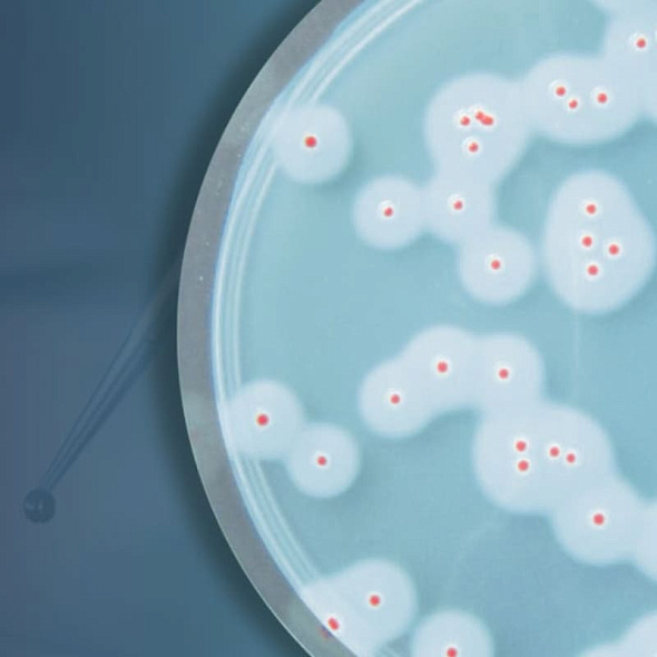 Вебинар «Лабораторный контроль Bacillus cereus»